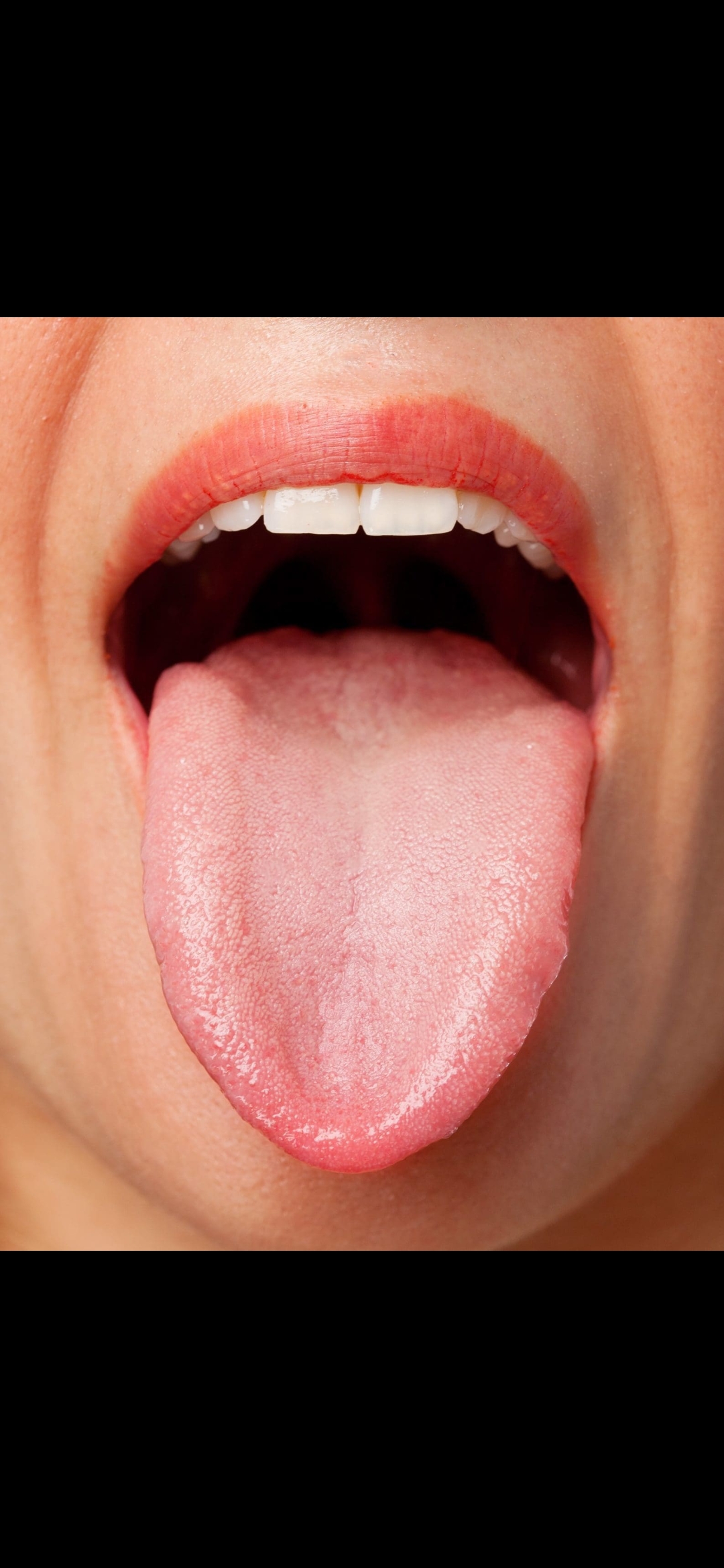Example of a clear tongue photo for submission.